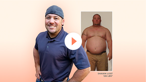 Shawn Lost 126 lbs with Orbera®